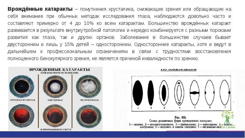 Тип наследования катаракты. Врожденные катаракты классификация. Врожденная катаракта Тип наследования.