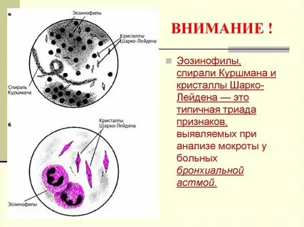 Альвеолярные макрофаги норма