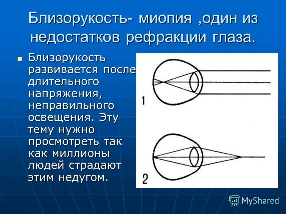 Тест по теме зрение