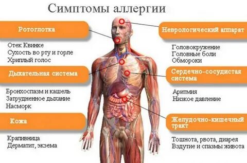 Может быть аллергия на человека