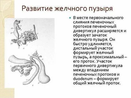 Аномалия желчного