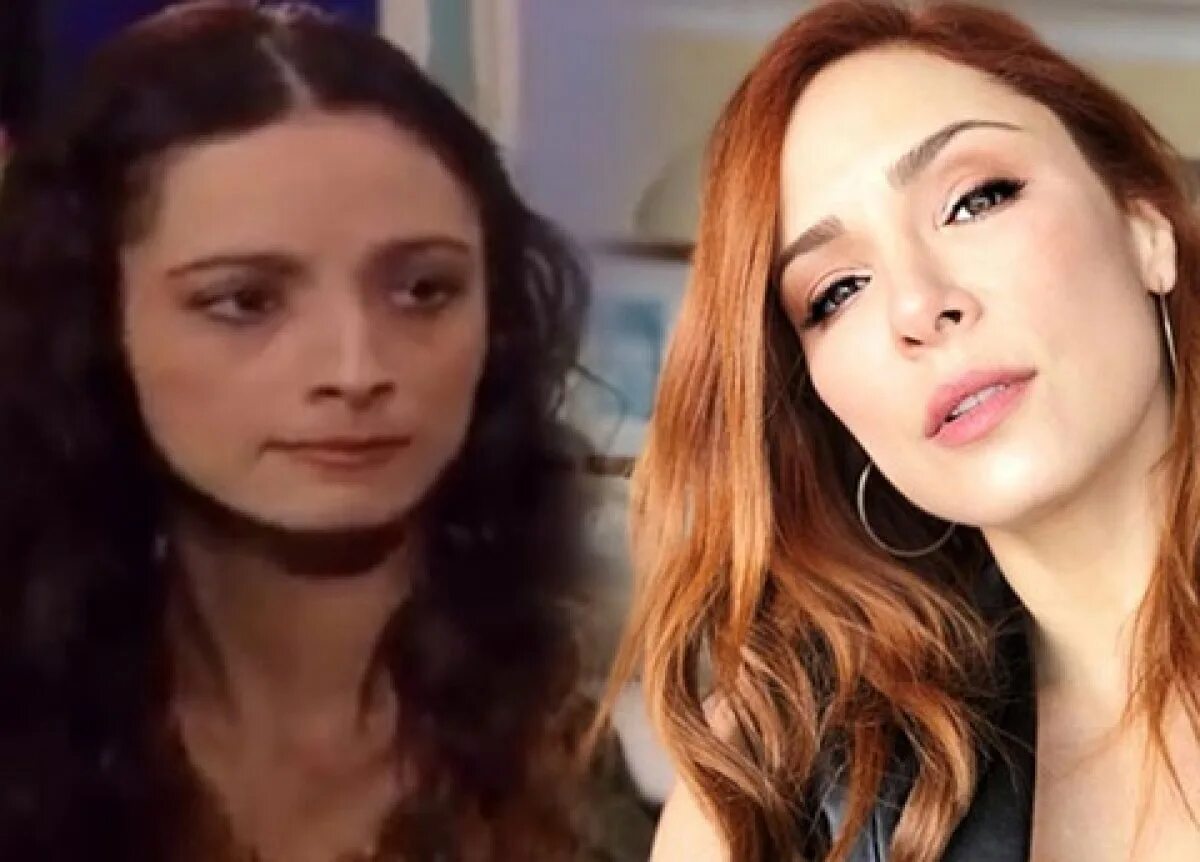 Мине тугай до пластики в молодости. Мине тугай пластика. Мине тугай до пластики в молодости. Мине тугай до операции. Мине тугай пластика.