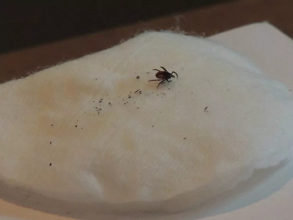 O que é febre maculosa e qual carrapato a transmite - Webstories GZH