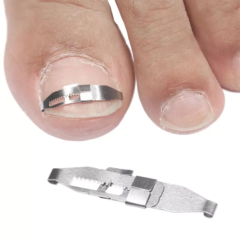 Nail polish remover pen. Корректор вросшего ногтя. Корректор для ногтей. Корректор ногтей. Correcteur корректор маникюра.