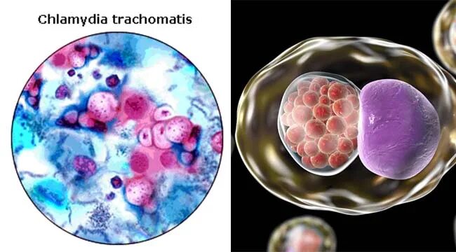 Хламидия трахоматис под микроскопом. Хламидии микробиология. Урогенитальный хламидиоз под микроскопом. Хламидии как выглядят