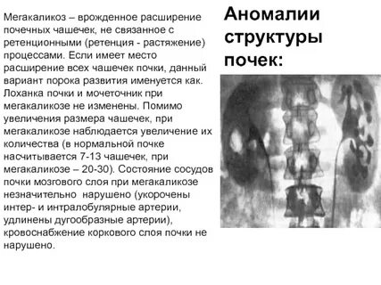 Структурная изменения в почках