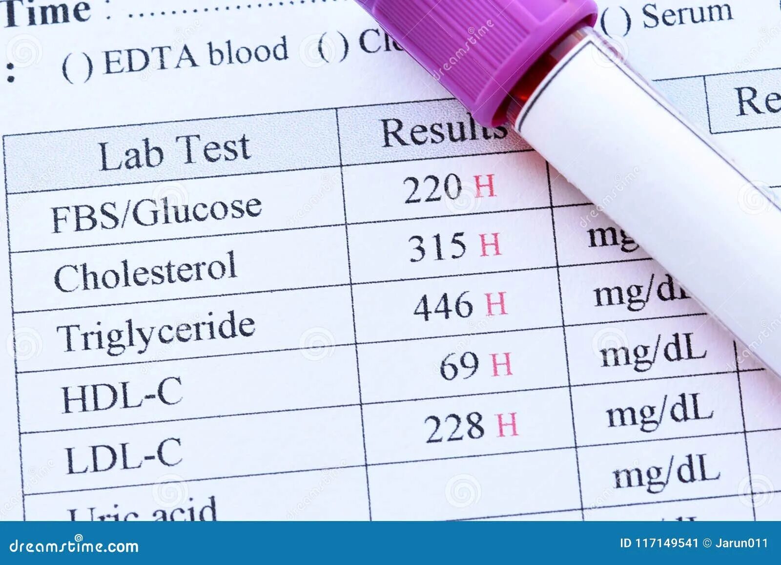 The results of the tests are. Blood test results. general blood test. laboratory blood test results. fbc blood test.