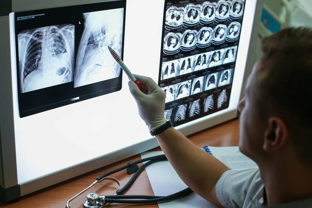 Заболевания легких обследование. Covid 19 диагностика. Обследование легких. Компьютерное томографическое исследование легких. Исследование пациента.