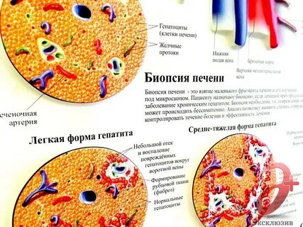 Подготовка к биопсии печени