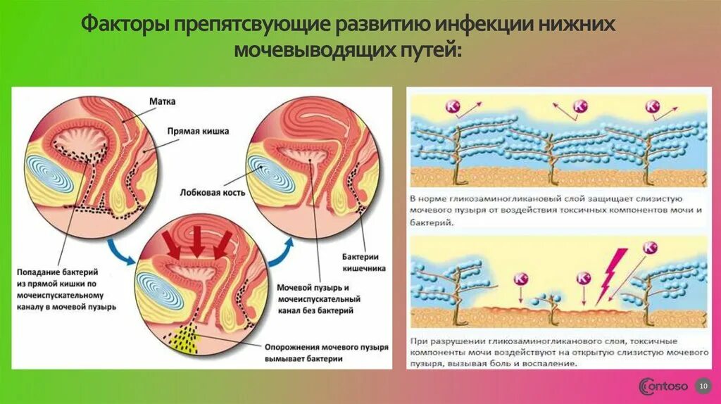 Цистит как передается. Бактерии мочевыводящих путей. цистит путь проникновения инфекции. презентация уретрита цистита. путь распространение инфекции при циститах у детей.
