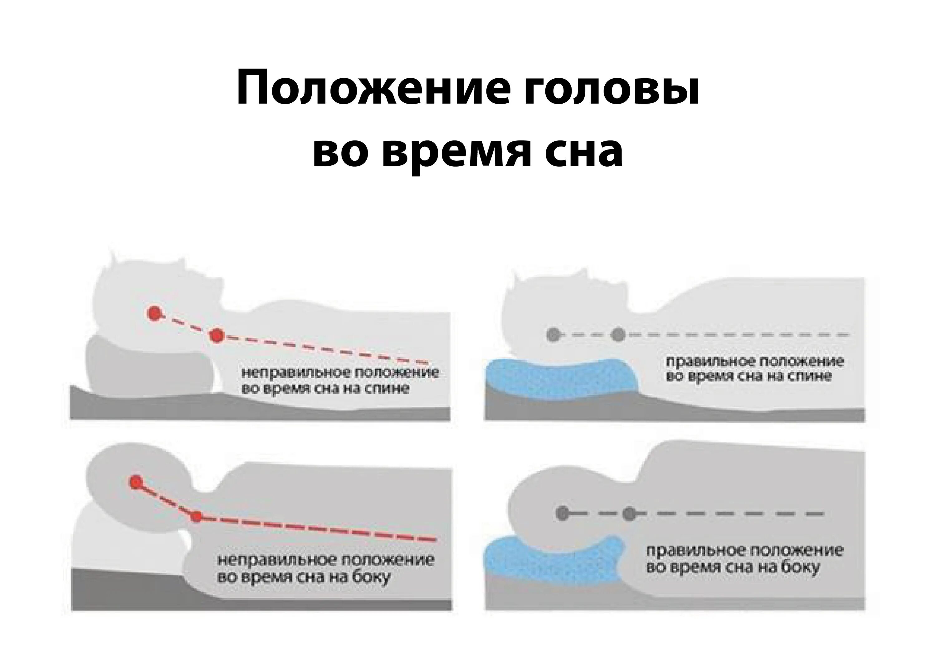 Правильное положение головы во время сна на подушке. Правильное положение головы и шеи во время сна. Правильное положение головы при сне. Правильное положение шеи во сне.