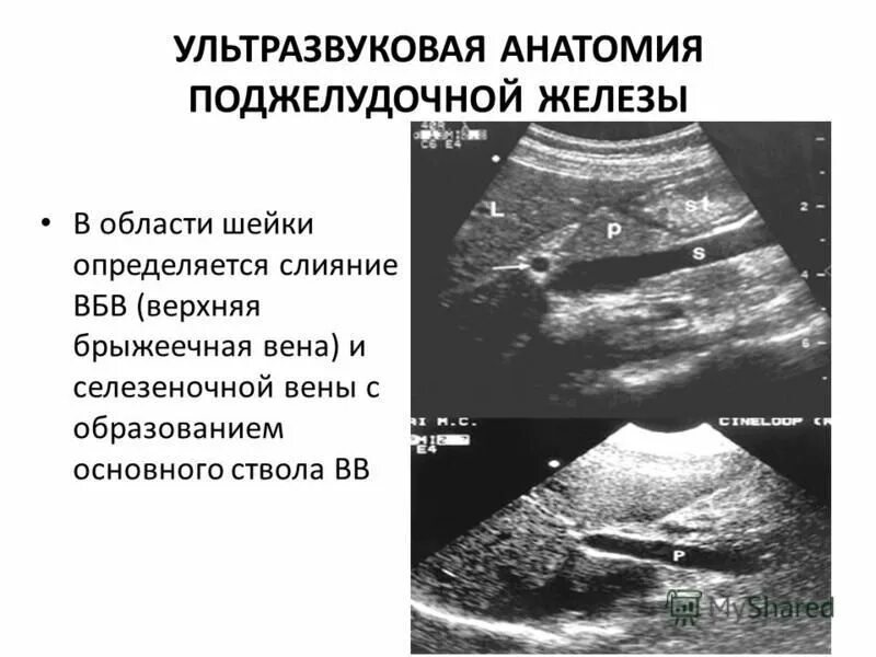 Как обследовать поджелудочную железу. Как обследовать поджелудочную железу