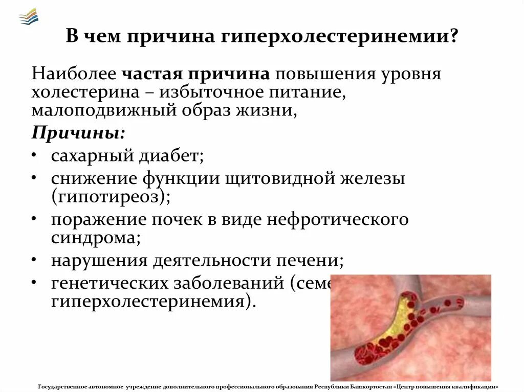 Почему повышенный холестерин. Гиперхолестеринемия биохимия. Причины вторичной гиперхолестеринемии. Гиперхолестеринемия причины. Причины повышения холестерина.