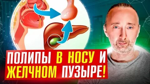Лечение полипа без операции отзывы