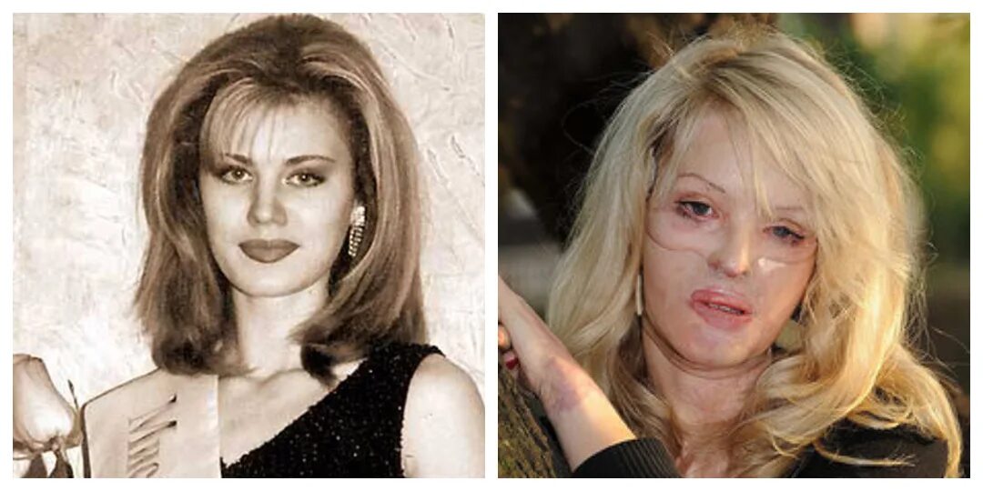 элеоноре кондратюк фото до и после. мисс очарование элеонора кондратюк. мисс сочи 1998 элеонора кондратюк. мисс сочи 1998 элеонора кондратюк. элеоноре кондратюк фото до и после.