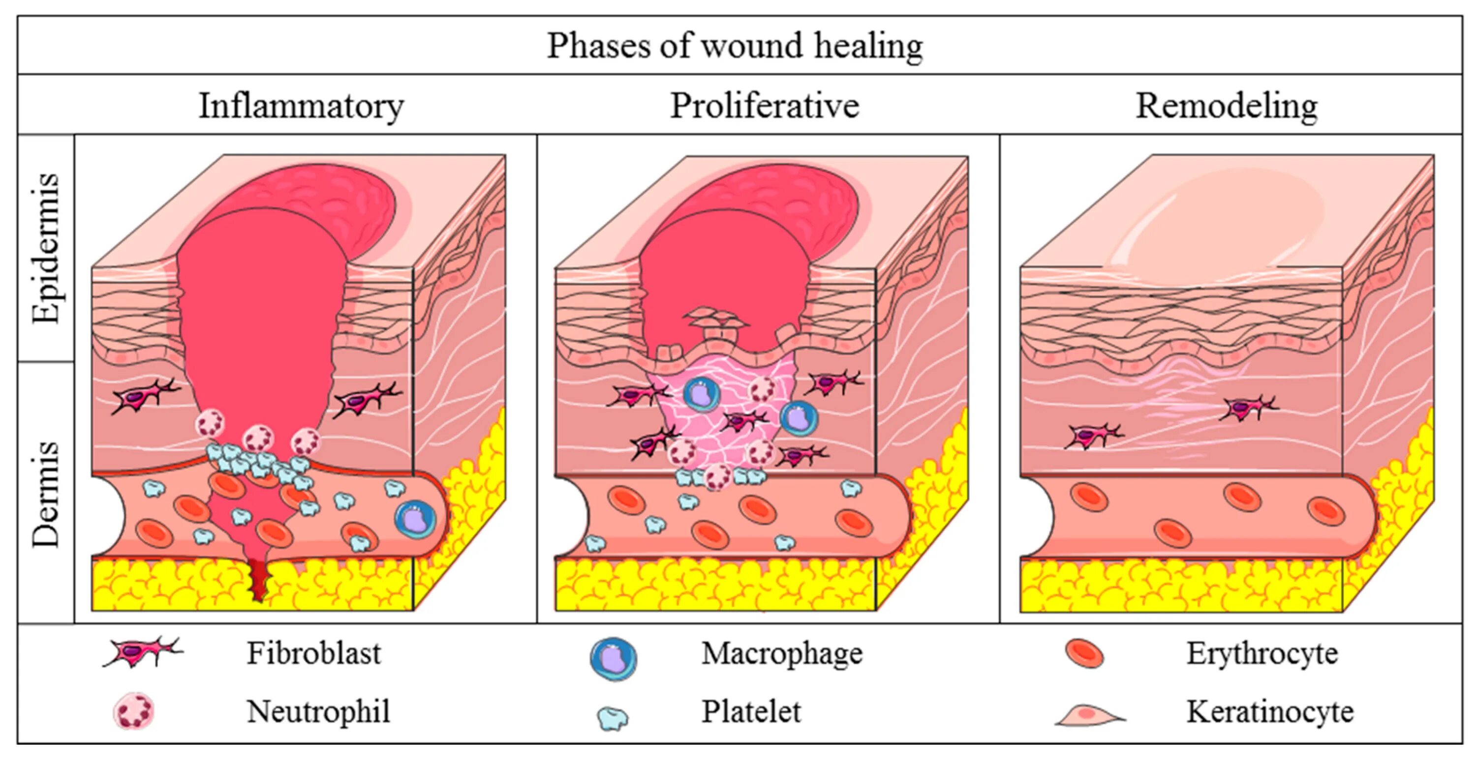 What is a wound