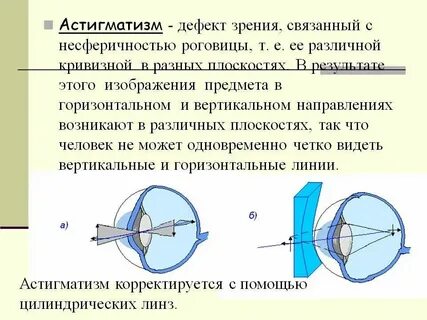 Транспозиция калькулятор астигматических