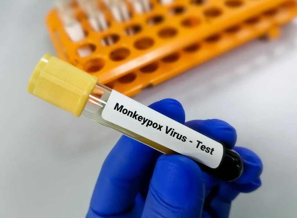 Virus testing