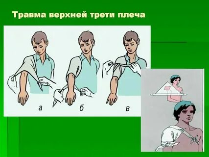 Травма верхней
