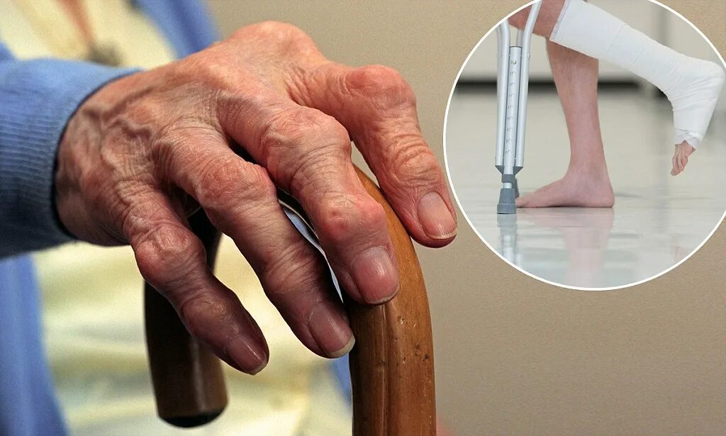 Ревматоидный артрит инвалидность какую дадут. Для ревматоидного артрита характерно. Ревматоидный артрит инвалидность какую дадут. Ревматоидный артрит классификация. Тактика ведения ревматоидного артрита.