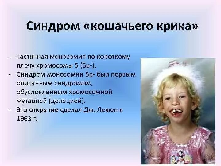 Что такое синдром крика. Что такое синдром крика