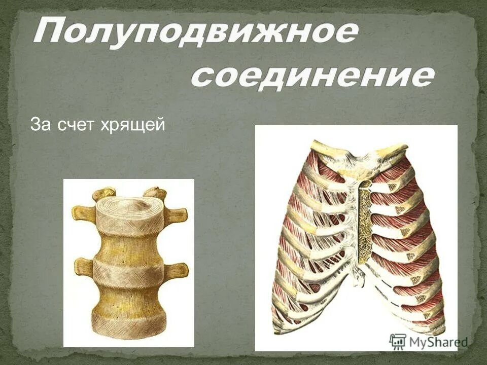 Полуподвижные кости пример. Голова полуподвижное соединение. Полуподвижное соединение хрящей. Полуподвижное соединение костей. Полуподвижное соединение ребер.