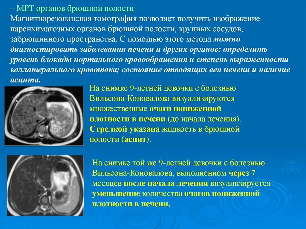 Компьютерная томография брюшной. Мрт органов брюшной полости. Кт брюшной полости и забрюшинного пространства. Мрт органов брюшной полости и забрюшинного пространства.