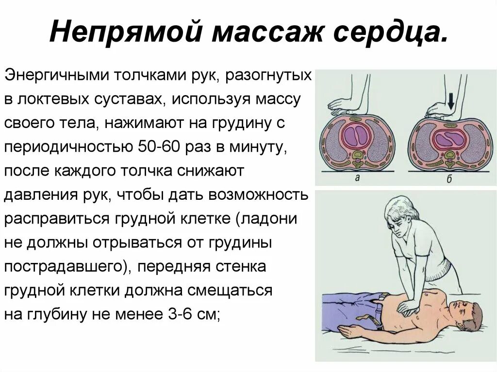 Непрямой массаж сердца осуществляется. Ритмичность непрямого массажа сердца. как делать массаж сердца обж. непрямой массаж сердца алгоритм действий кратко. нпмс ( непрямой массаж сердца.
