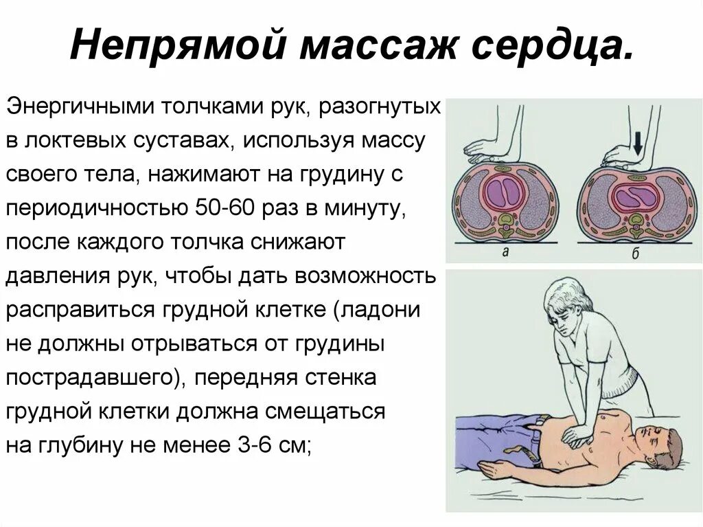 Как проводится непрямой массаж сердца. Ритмичность непрямого массажа сердца. Непрямой массаж сердца конспект кратко. Непрямой массаж сердца ОБЖ. Как делать массаж сердца ОБЖ.