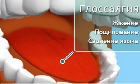 От чего может болеть язык