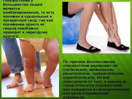 Плоскостопие признаки симптомы