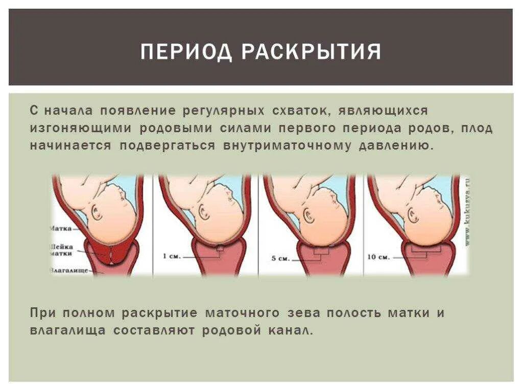 Два пальца сколько раскрытие. Раскрытие шейки матки при родах периоды. 1 Период родов раскрытие шейки матки. Стадии раскрытия шейки матки при родах. Раскрытие шейки в родах.