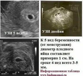 Яйцеклетка видна на узи