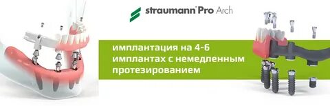 Arch pro
