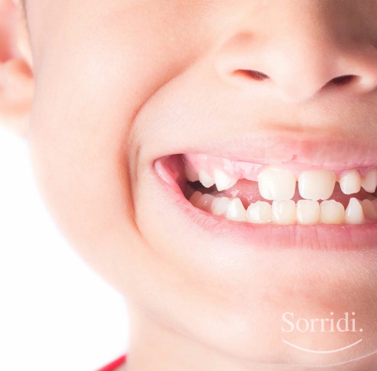 Как укрепить зубную эмаль. Мальчик чистит зубы для детей. Как укрепить зубы ребенку. Как укрепить зубы ребенку. Продукты полезные для десен.