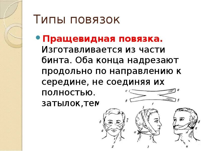 Техника наложения пращевидной повязки. Пращевидная повязка. Пращевидная повязка алгоритм.