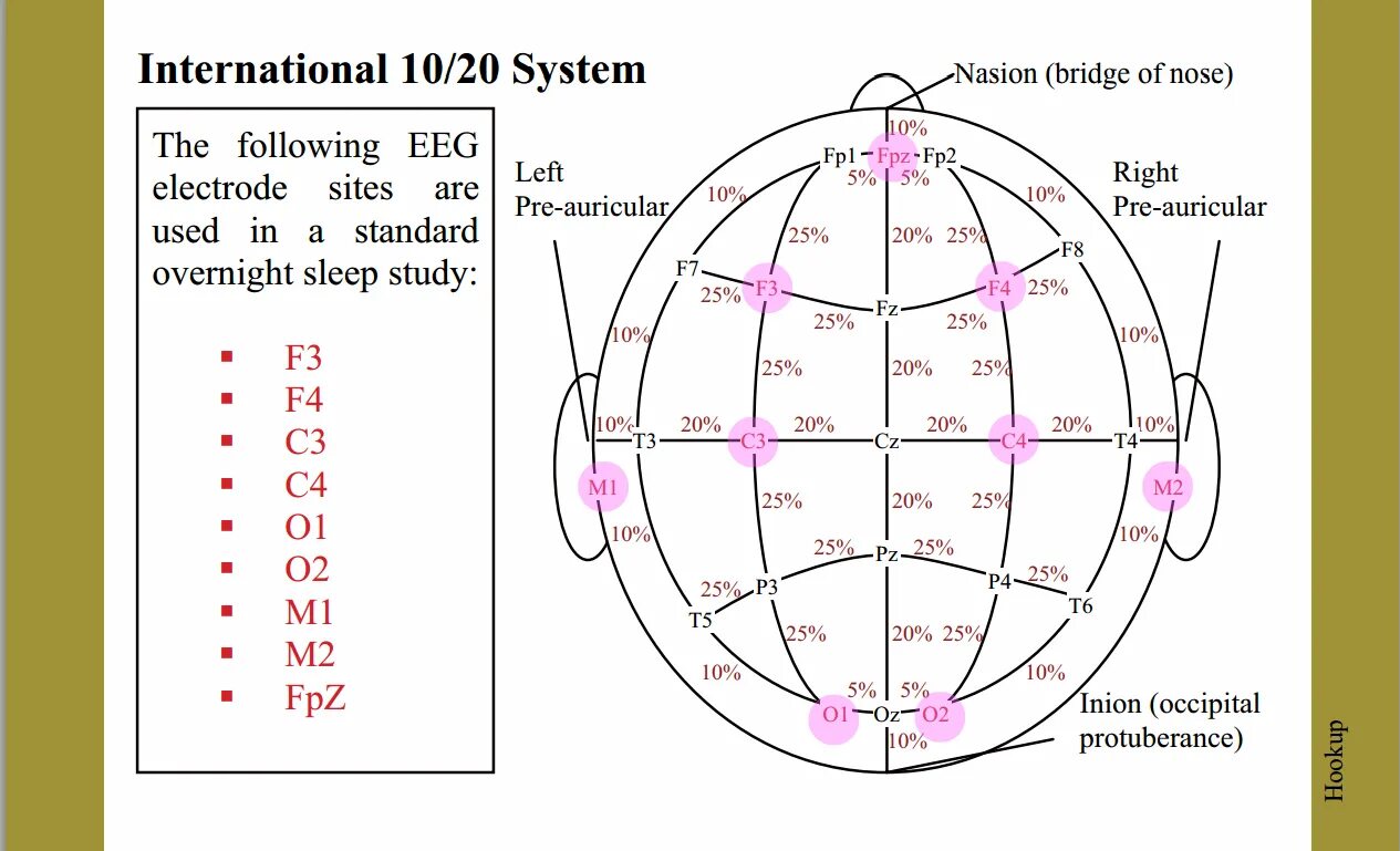 Система ээг. 10 20 ЭЭГ Международная система. Схема 10-20 наложение электродов. 10-20 EEG. Система 10 20 электроэнцефалография.