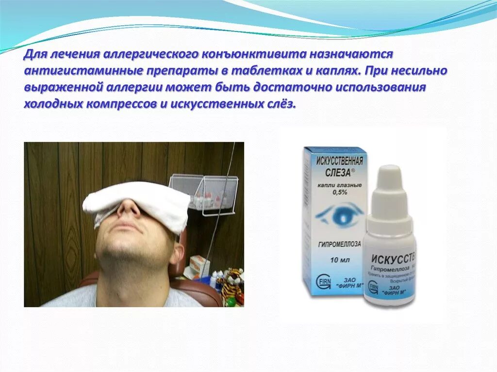 Конъюнктивит лечение средство. Чем лечить конъюнктивит. Препараты от аллергического конъюнктивита. Терапия при конъюнктивите. Терапия аллергического конъюнктивита.