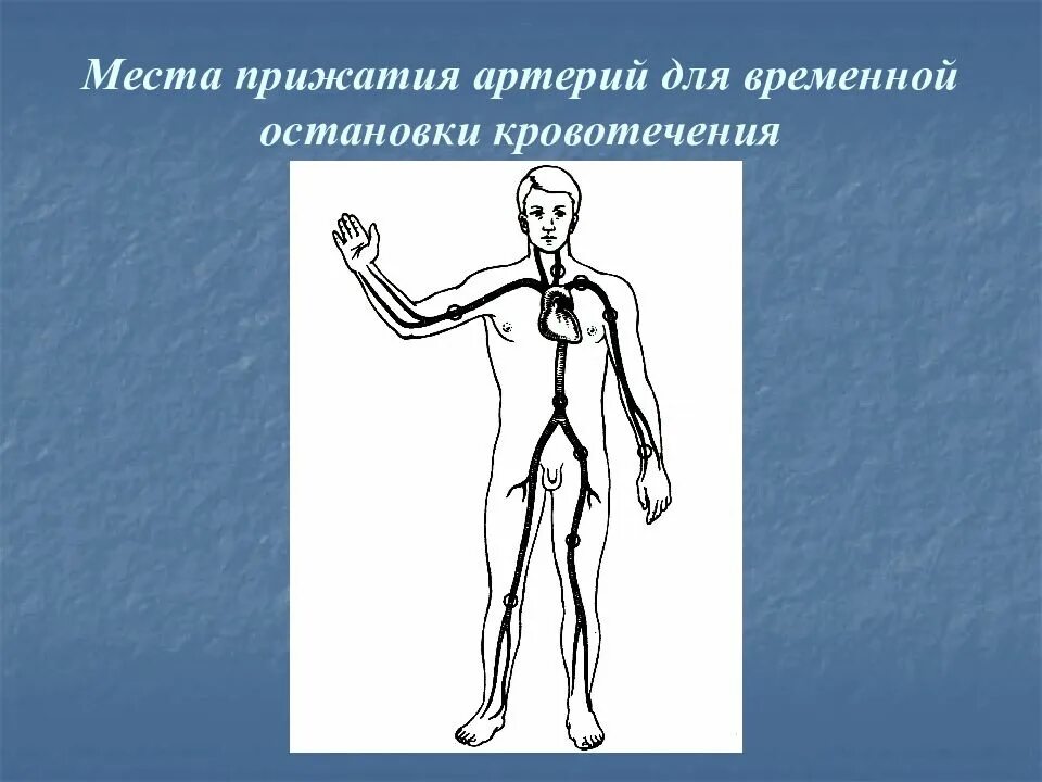 Точки пальцевого прижатия артерий. 2 Основные точки пальцевого прижатия артерии.. Места прижатия артерий. Места прижатия артерий для временной остановки.