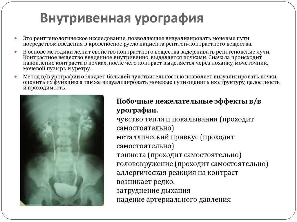 Побочный эффект кт