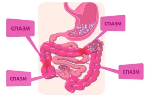 Спазм кишечника форум