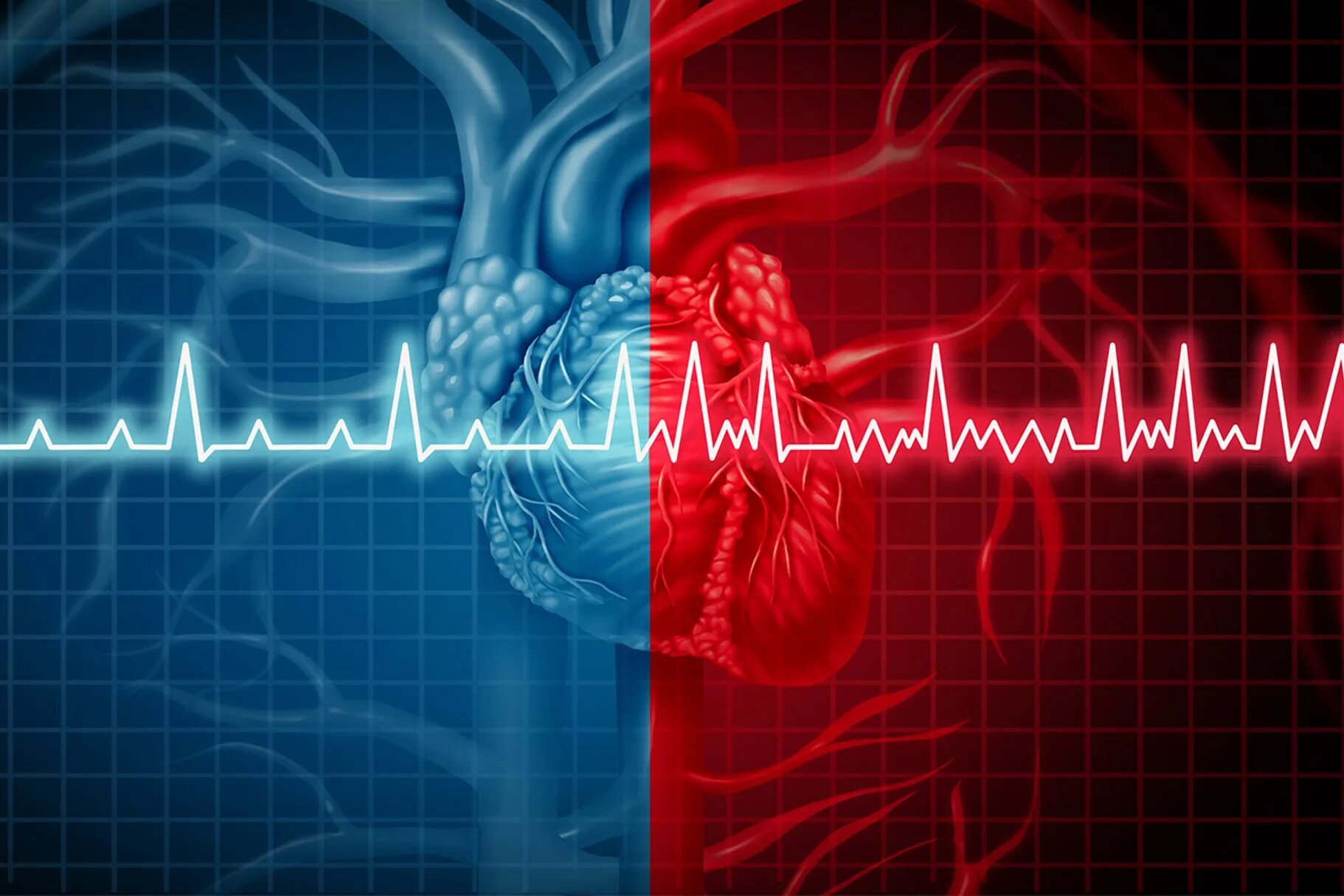 Аритмия и гипертония. Кардиограмма сердца. Кардиология аритмии. Аритмия на ЭКГ. Сердечный ритм картинка.