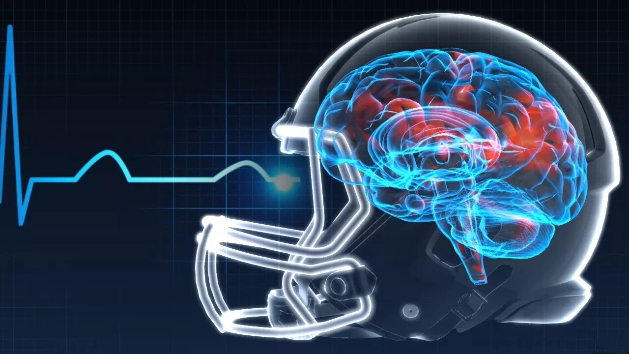 Сотрясение 2013. Мозг и движение. Спорт движение мозг. Мозг и движение картинки. Concussion diagnosis.