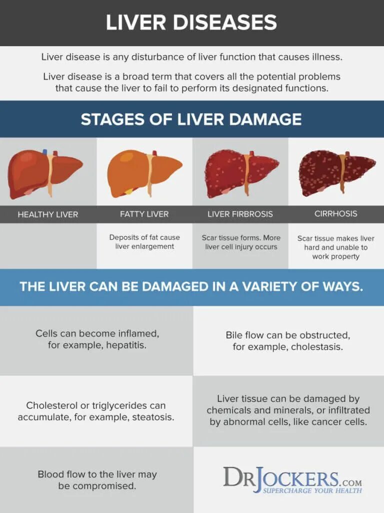 Болит печень лекарства. Воздействие лекарств на печень. Печень влияние на организм. Лекарство для желудка влияющие на. Влияют ли таблетки на желудок.