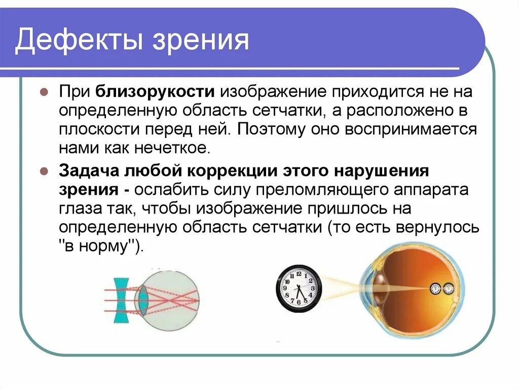 Какое зрение при дальнозоркости. Коррекция линзами дефектов зрения. Дефекты зрения. Дефекты зрения близорукость. Дефекты зрения и их исправление.