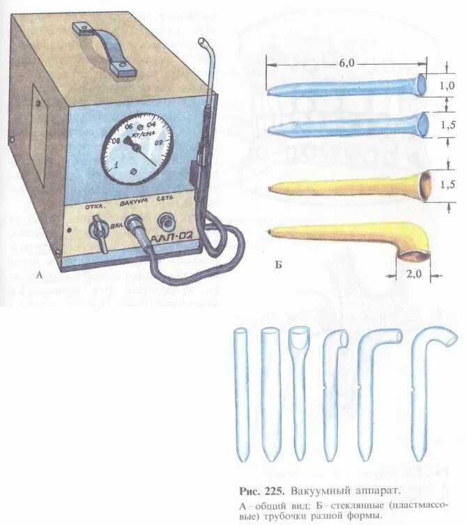 Вакуумный аппарат Кулаженко. Вакуум массаж аппарат Кулаженко. Вакуумная проба Кулаженко. Вакуумная терапия методом в. и. Кулаженко.