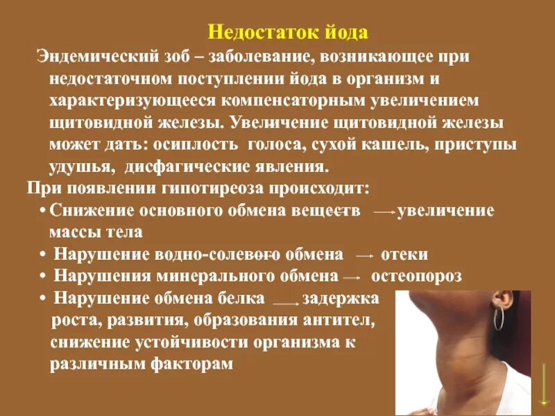 Гипотиреоз недостаток йода. Щитовидка дефицит йода. При недостатке йода возникает. Недостаток йода в организме заболевание.