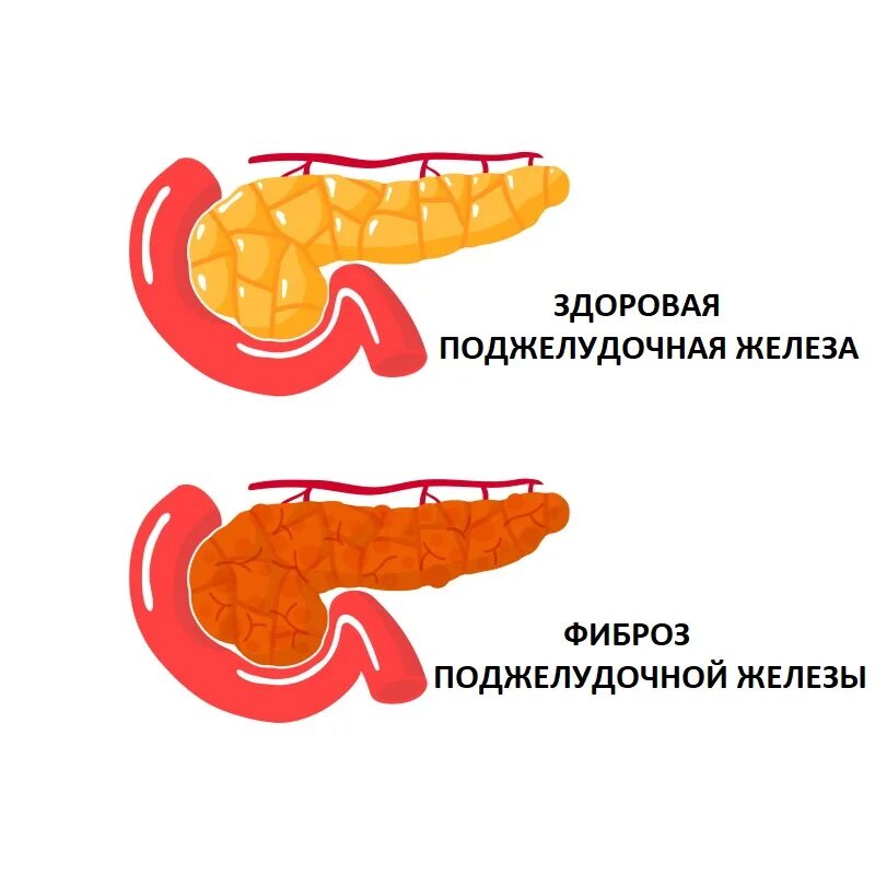 Липаза поджелудочной железы. Липазы в организме человека. Панкреатическая липаза биохимия. Липаза в тонком кишечнике.