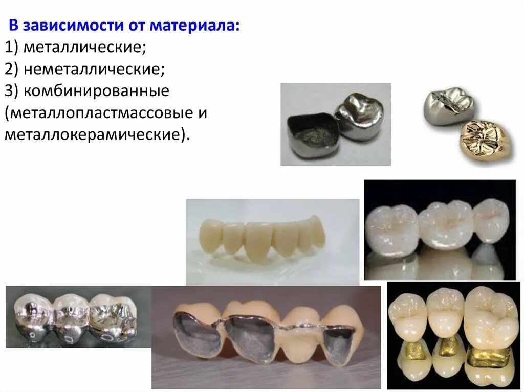 Коронка сплав цельнолитая. Металлокерамическая коронка (сплав COCR). Мостовидный протез металл керамика. Коронки диоксид циркония оттенки.