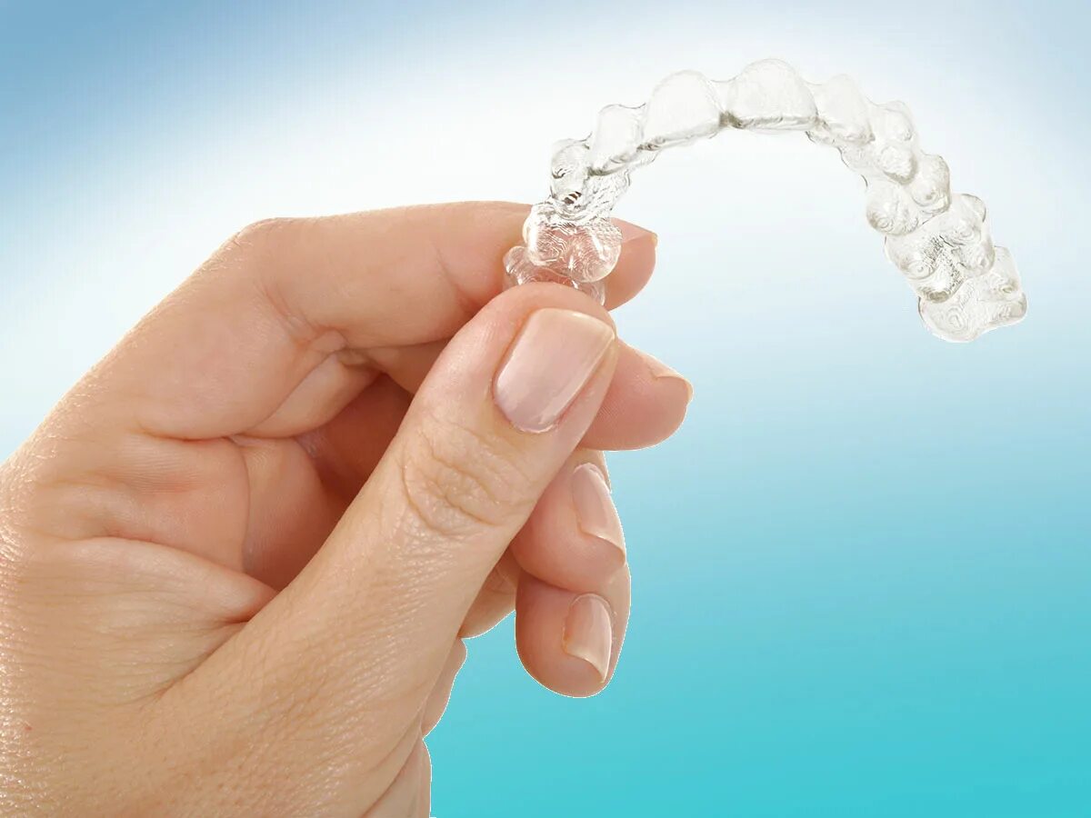 Clear фото. Элайнеры Clear Aligners. Элайнеры Invisalign. Элайнеров Invisalign.